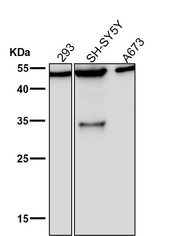 WB - Anti-KLF4/Gklf Rabbit Monoclonal Antibody ABO13501